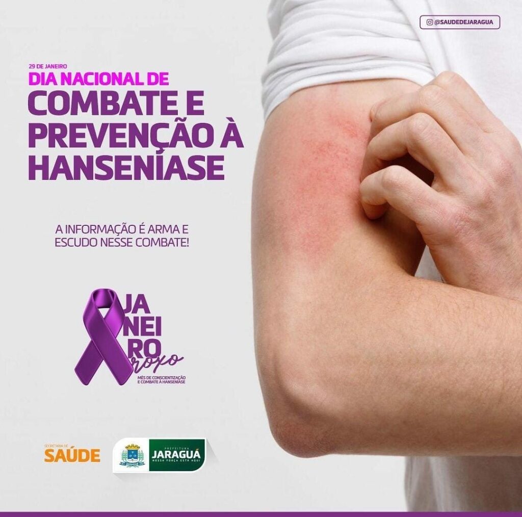 Prevenção da hanseníase: conheça os sintomas e tratamentos